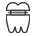 Implant Retained Overdentures