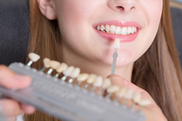 Crowns and Veneers